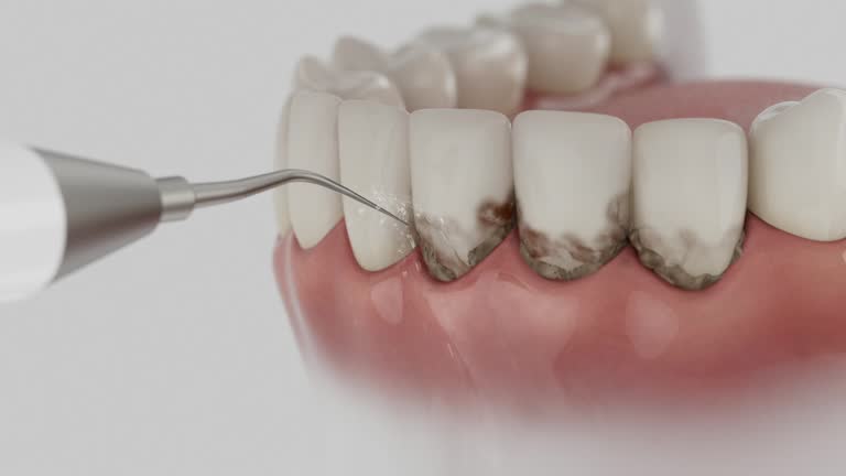 Reliable Dental contractor in Hyde, PA by Smile Center Dentistry